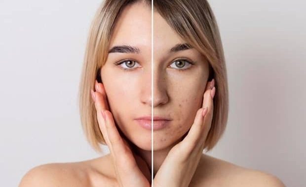 Difference Between Dry Skin And Oily Skin