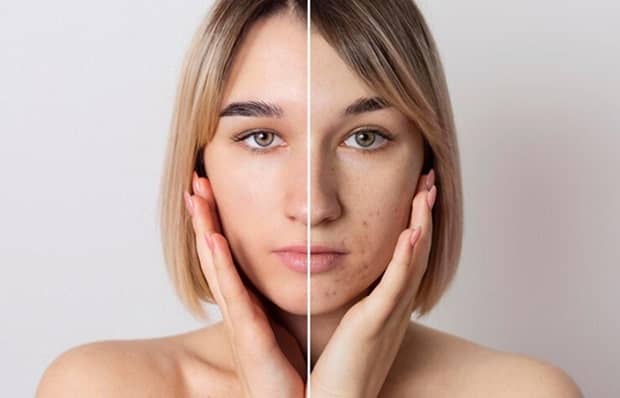 Difference Between Dry Skin And Oily Skin